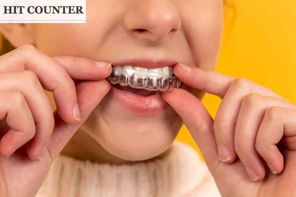 ortodoncia invisible invisalign